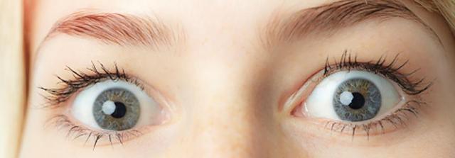 Junge reißt erstaunt die Augen auf