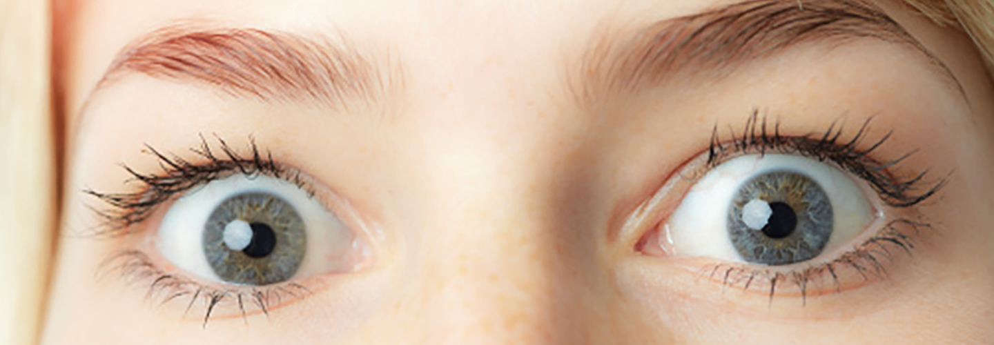 Junge Frau mit staunenden großen Augen